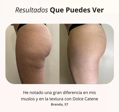 DolceBand™