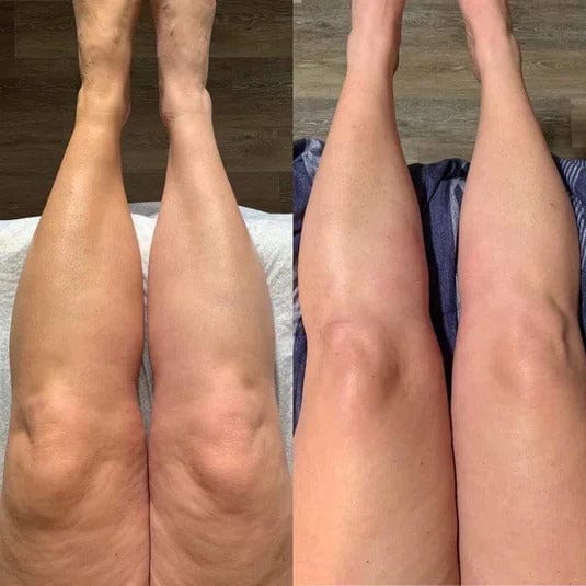 ugc_legs_ba